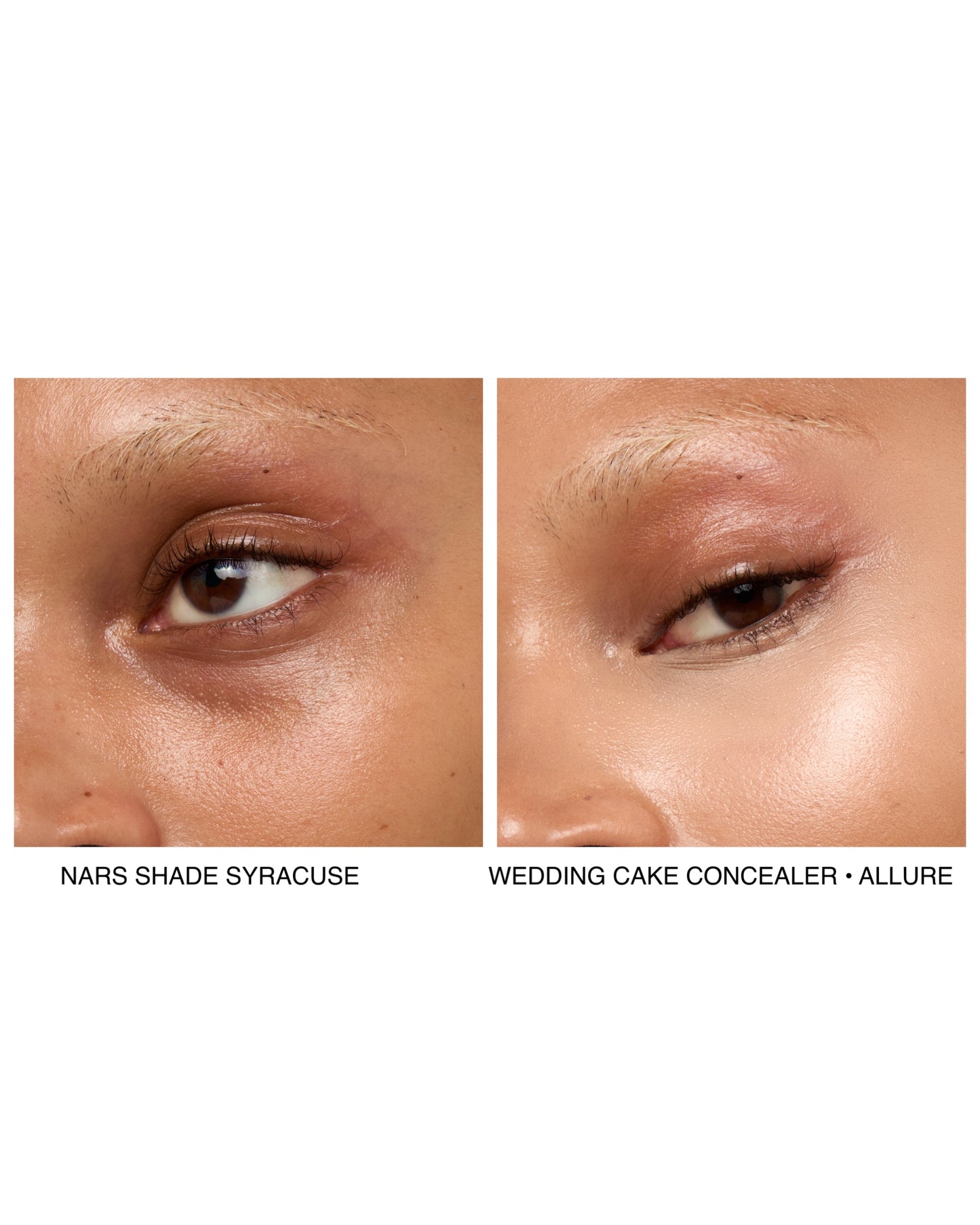 ALLURE